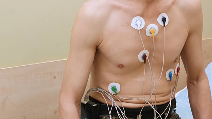 Holter Rythmique